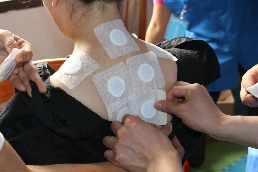 贡方堂冬病夏治正当时三伏贴究竟是治病良方还是骗局