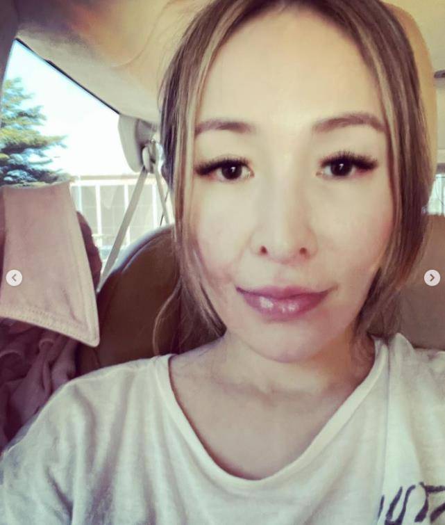 原创萧亚轩素颜曝被狗咬伤需动手术练习说话保持面部平衡