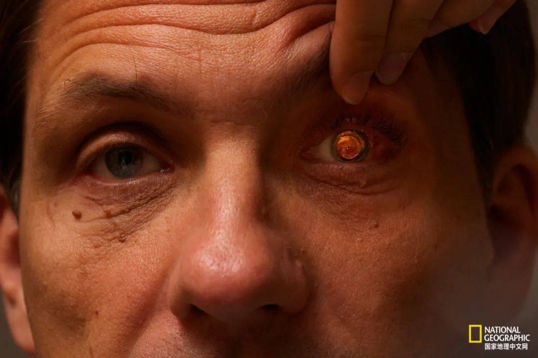 这篇文章是"百眼蜈蚣精"变的吗?_眼睛_复眼_水母