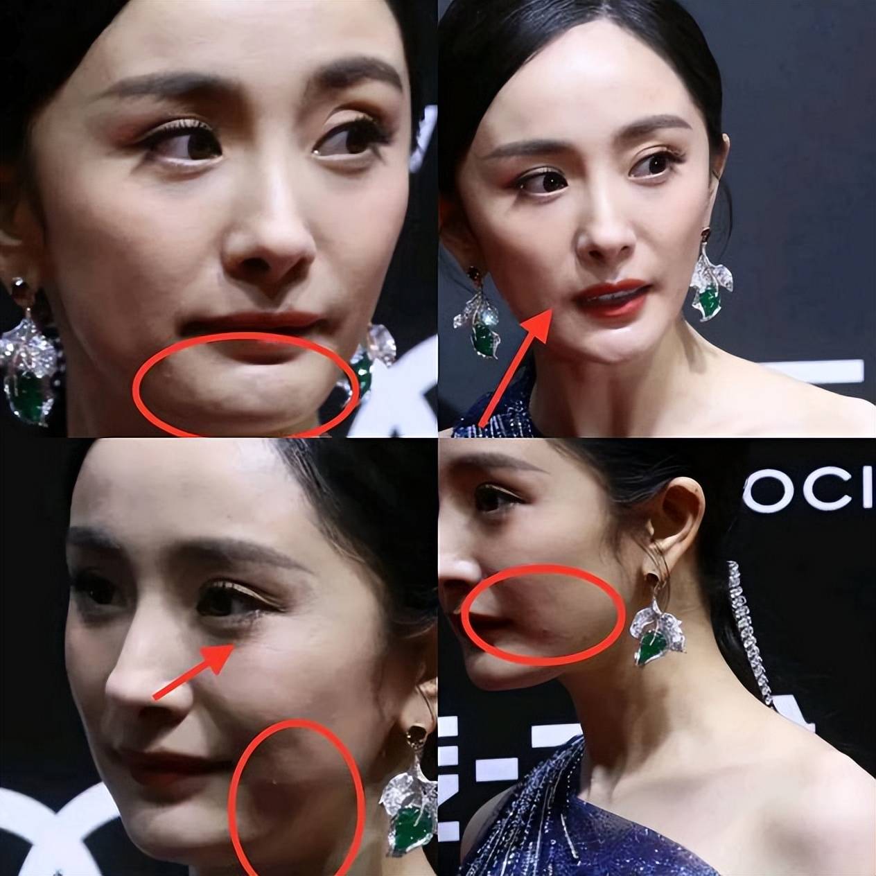 蒋欣的麒麟臂,宋佳的法令纹,打了多少"花瓶"女星的脸_演技_因为_隋俊