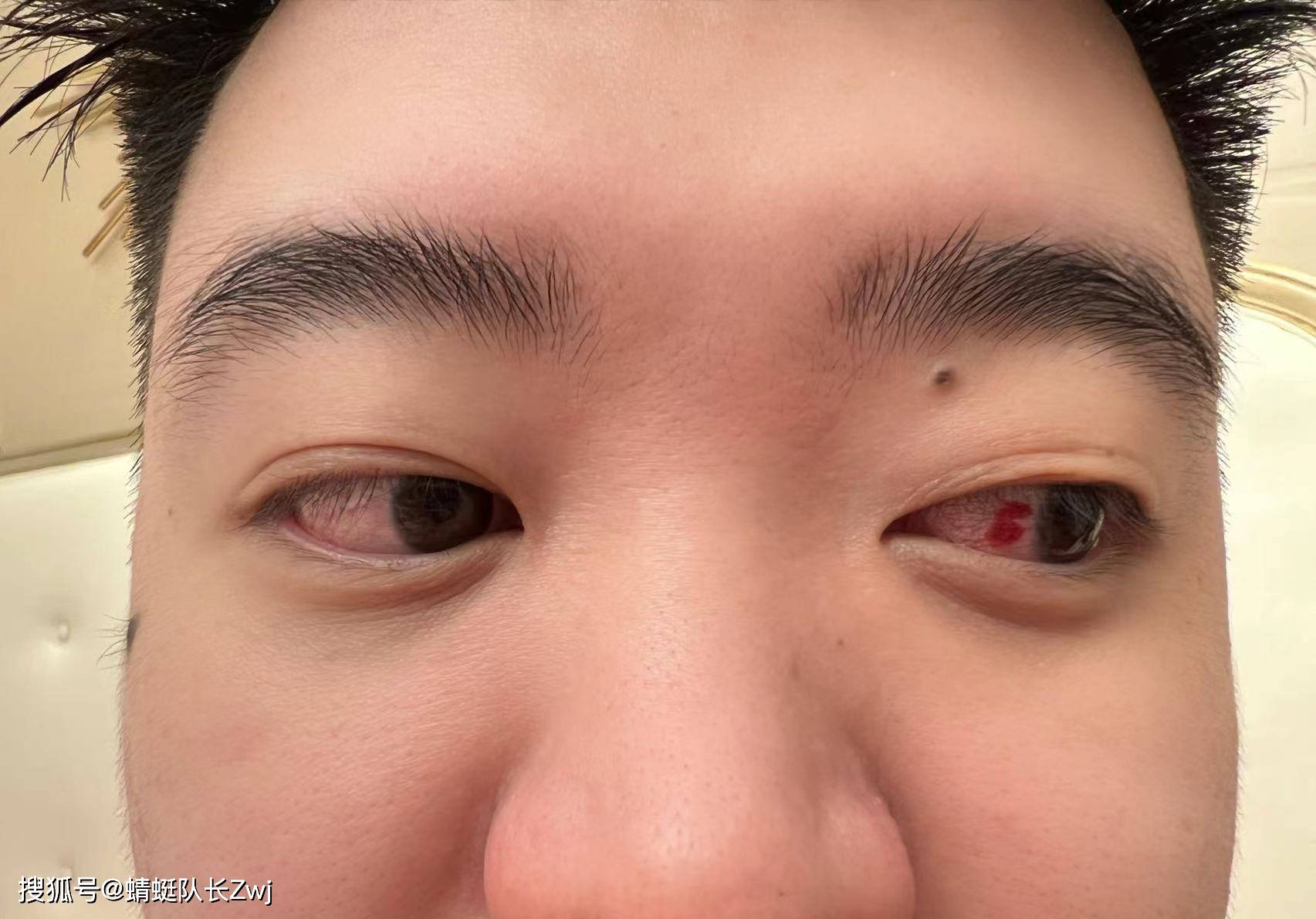 lgd老板ruru直言:我又没惹过burning,骂我干嘛_inflame_徐志雷_直播