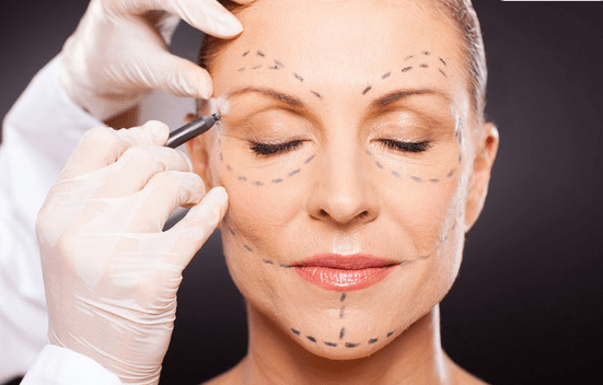 讲真拉皮手术多大年龄做合适脸部拉皮手术能维持多久呢