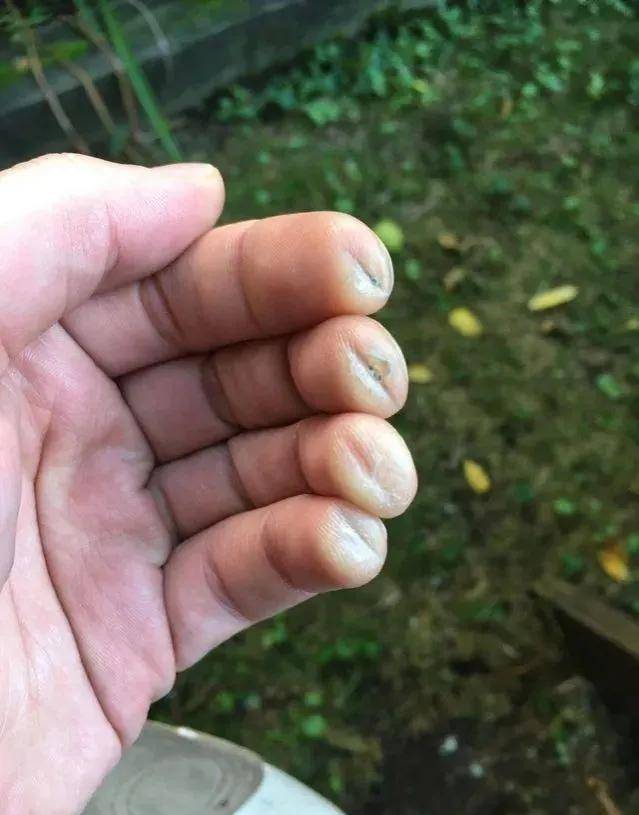 弹了15年吉他的手上的老茧!上个世纪初的防火服!