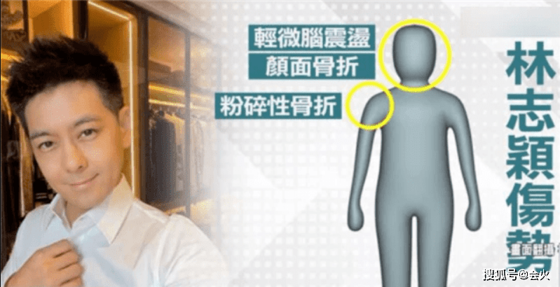 林志颖目前转清醒!妻子陈若仪发文斥传流言者