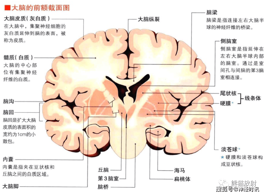 大脑矢状位解剖图图片