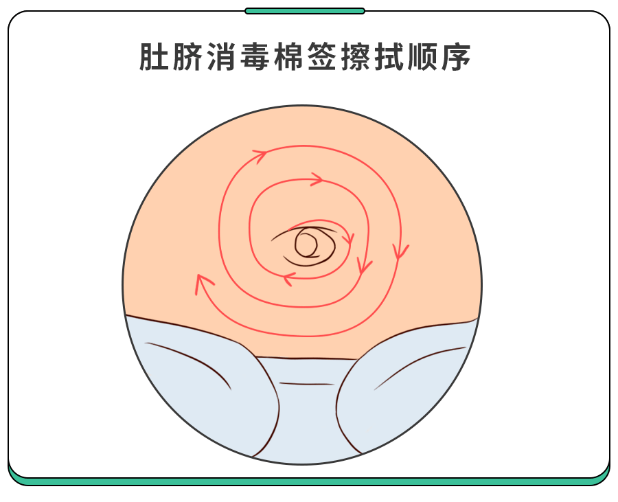 新生儿肚脐应该怎样处理?告诉你一个非常简单的方法