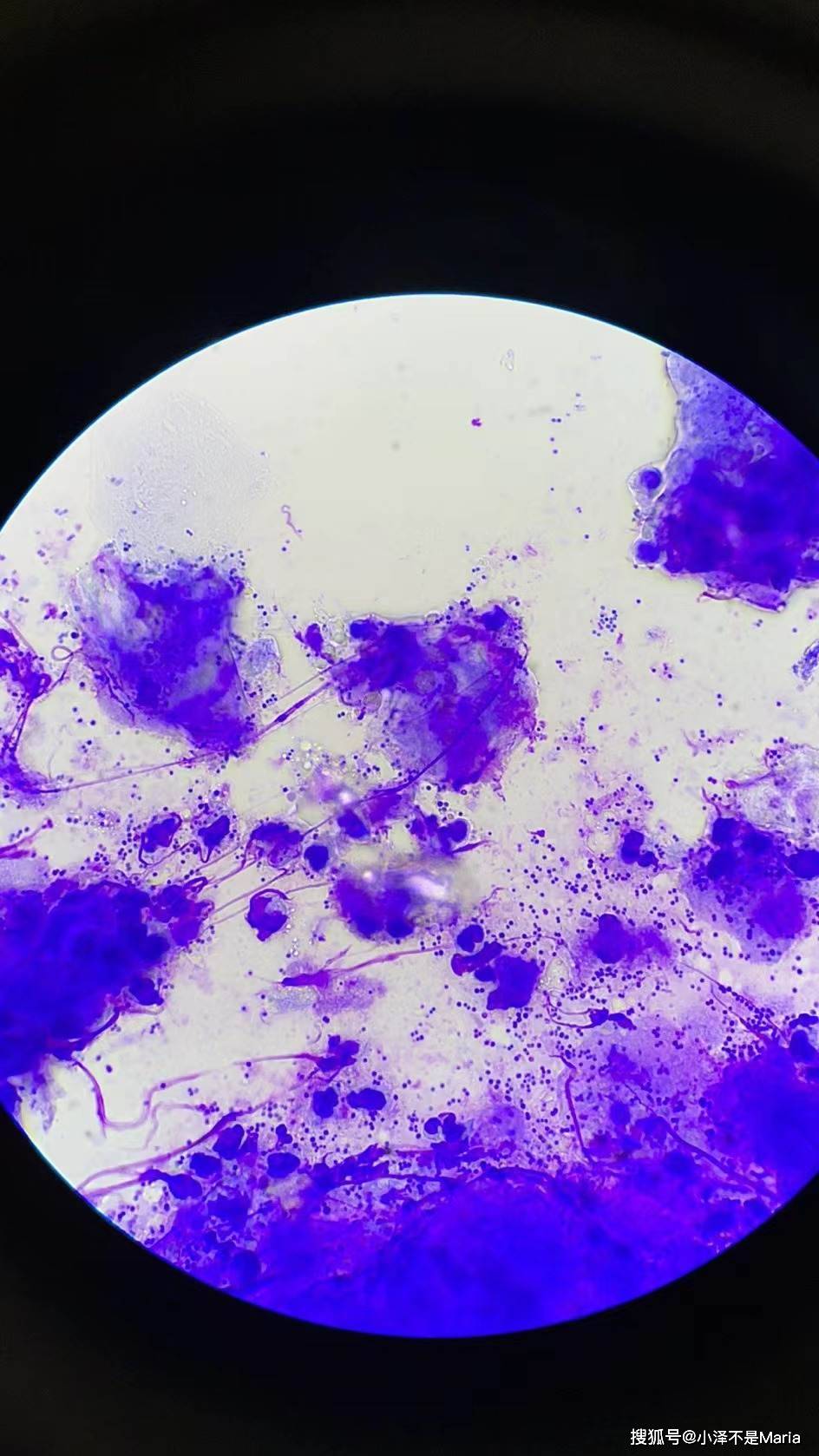 夏季潮湿谨防猫咪耳部感染球菌记录一次新一君的就医之旅