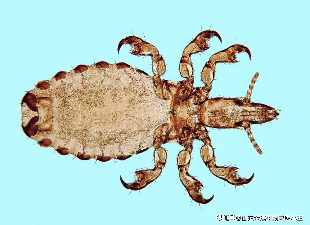 血虱病如何治疗?