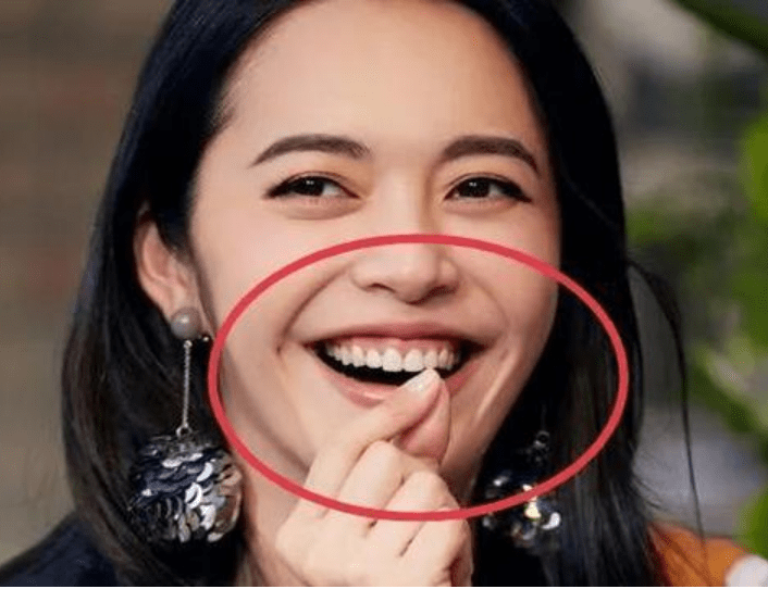 刘涛牙齿脱落,吴宣仪嘴巴合不上,明星们的大白牙真的好看吗?