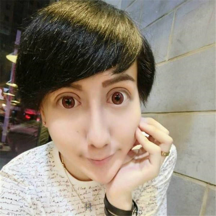 20岁网红自曝感染新冠,发文哭诉自己太无助,曾因整容过度致毁容_刘梓