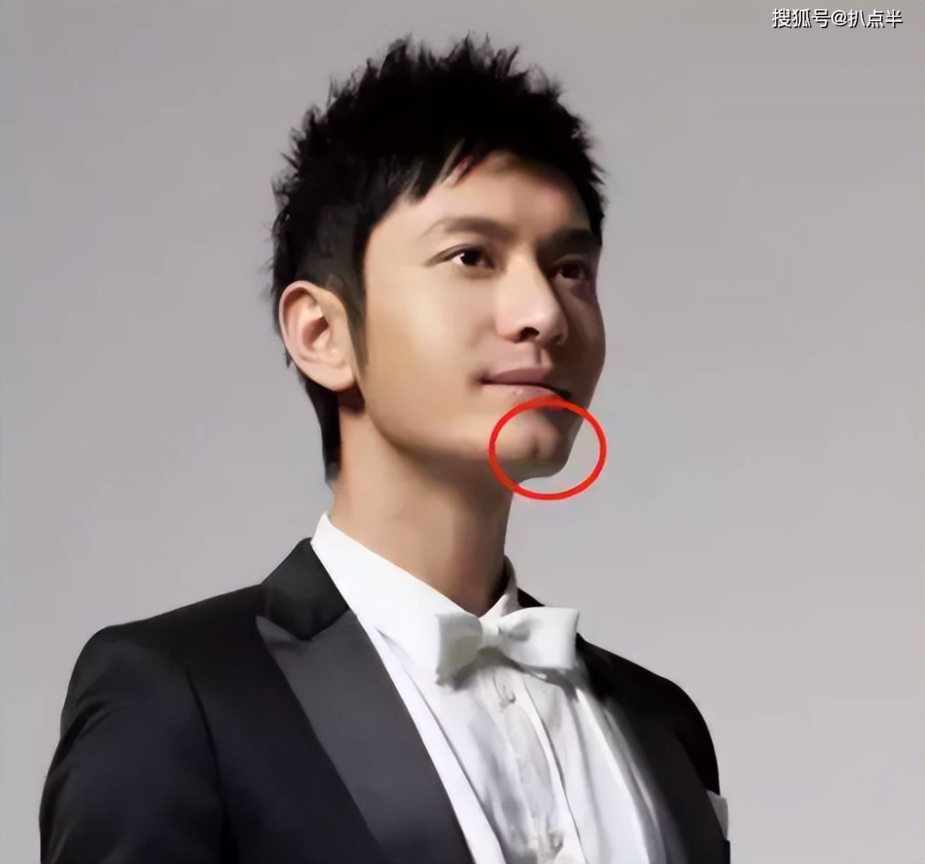 走红之后,大家都以为他下巴上长了一道漂亮的美人沟,但事实上其实那是