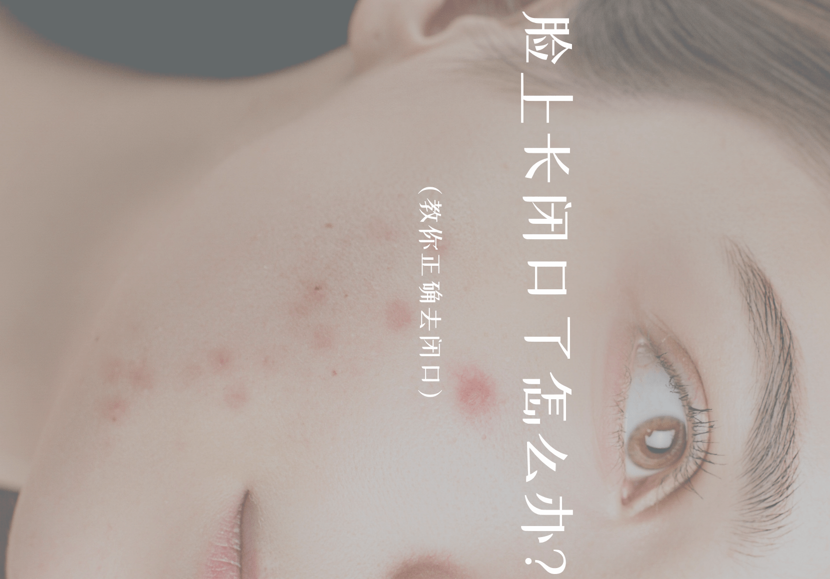 脸上长闭口了怎么办?教你正确去闭口!-搜狐大视野-搜狐新闻