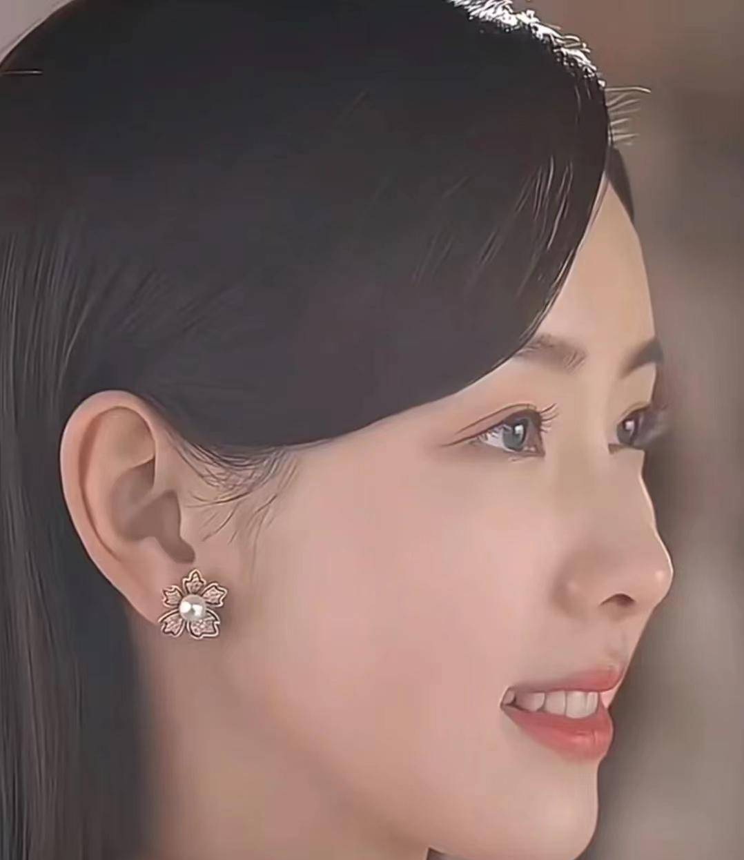 整牙不是病丑起来才要命 盘点杨紫,高圆圆,杨幂……整牙女星_牙齿