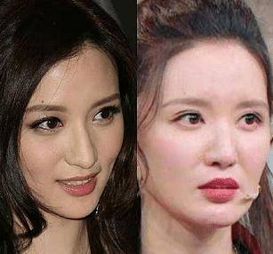 40岁张萌近照曝光,脖子比例失调尖下巴抢镜,被质疑整容_网友_视频