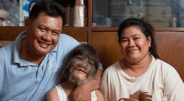 对此科学家的解释是"返祖",这种返祖现象非常少见,不过虽然体毛长