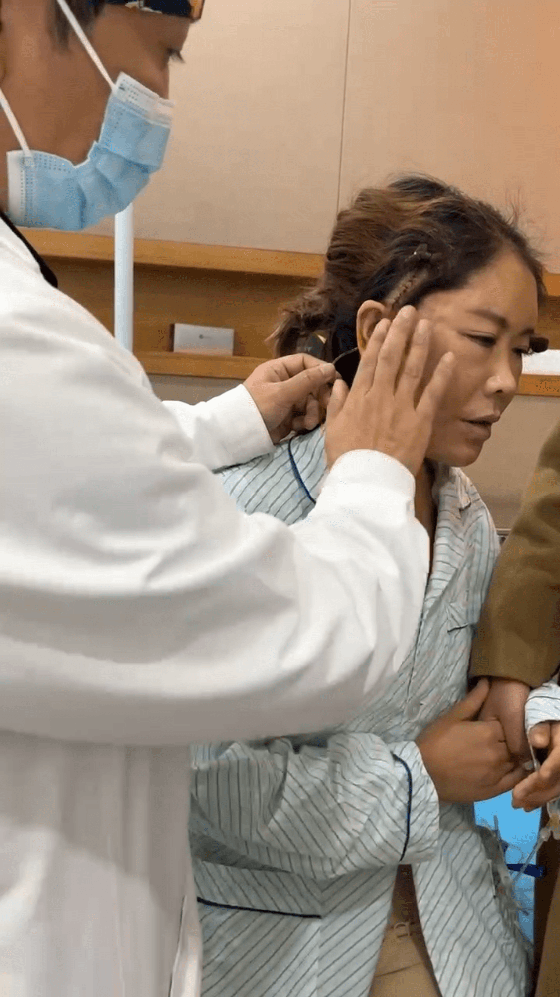 大拉皮手术后第三天,公开手术全过程_切口_面部_姐妹