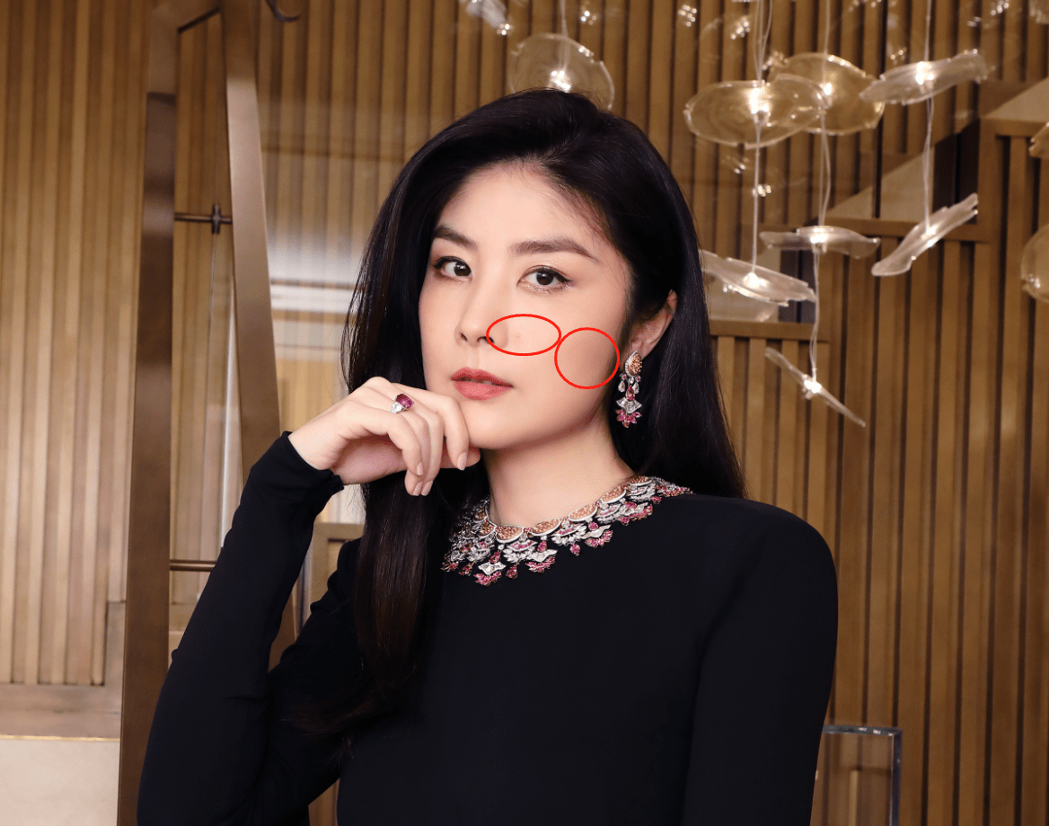 不过,其中一张照片中还是能够明显看出车祸在陈慧琳脸上留下的2处伤疤