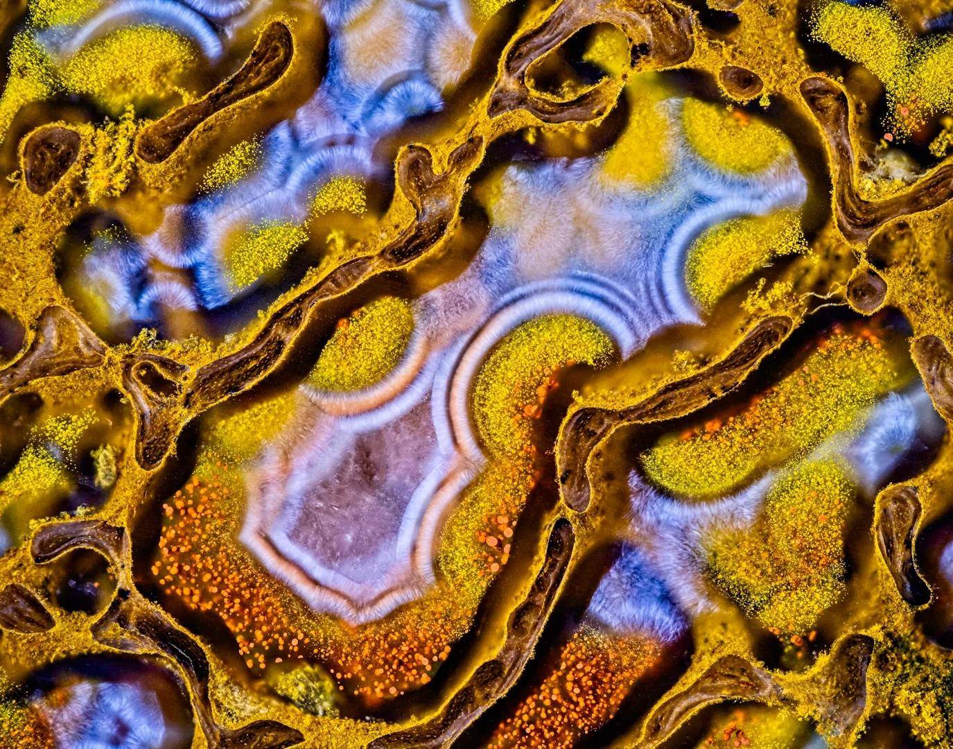 9张令人惊叹的微观世界照片_物镜_ole_骨骼