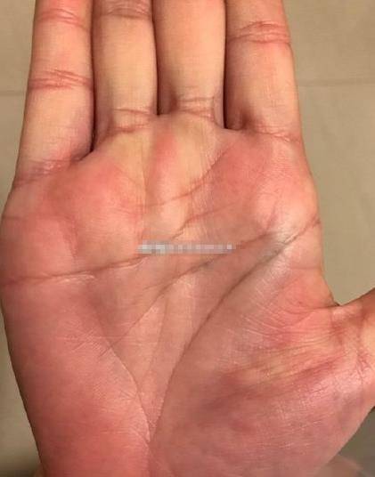 你的的感情线到金星就停止了,金星环的心态也不是很好,手中健康线也