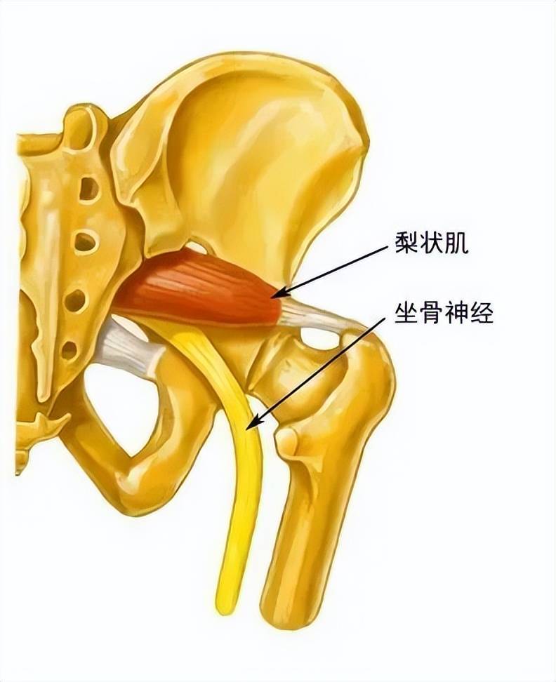 股骨头和坐骨的示意图图片