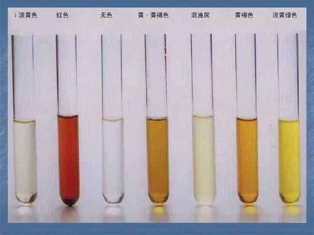 尿液颜色对比卡图片