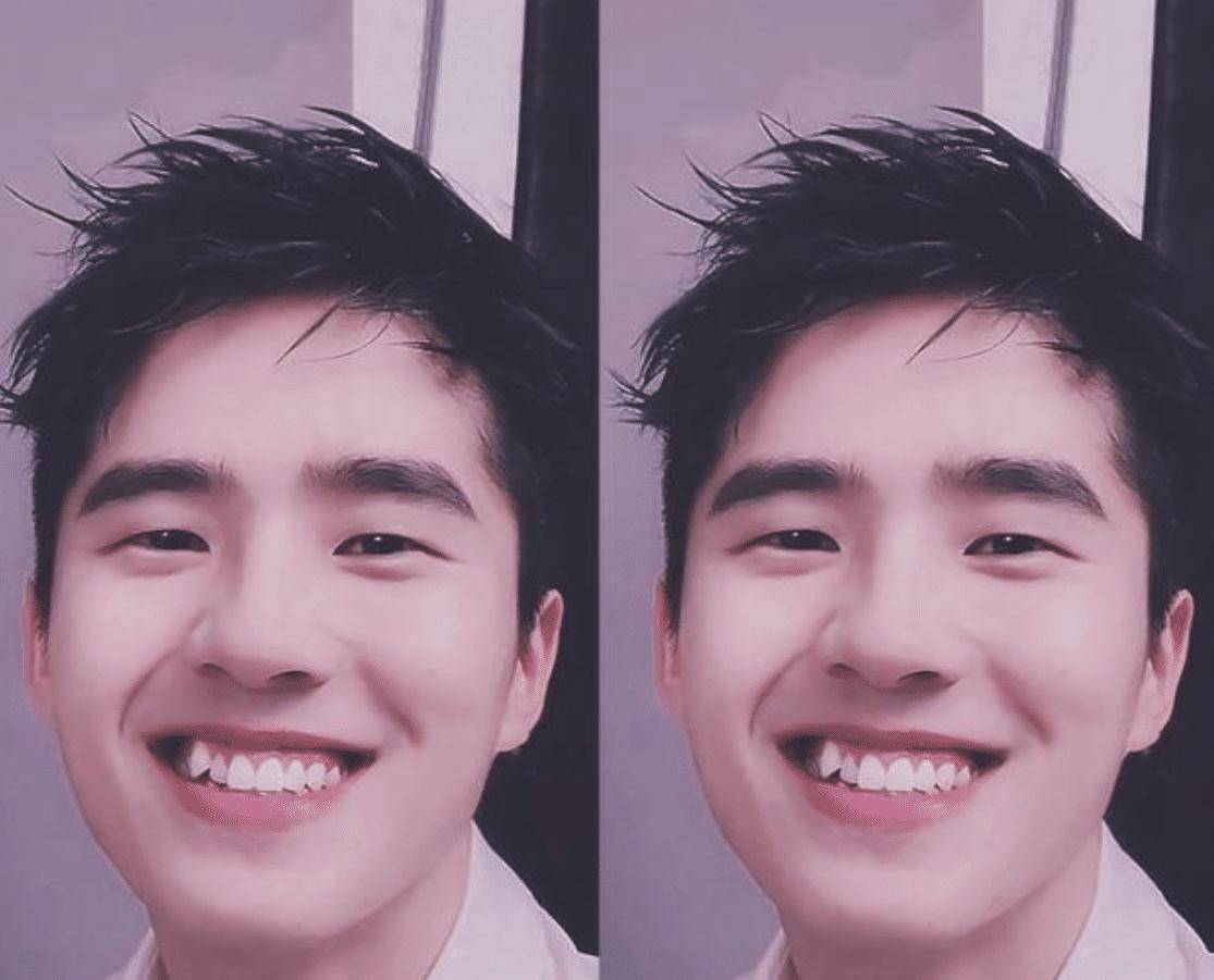 烤瓷牙统治了半个娱乐圈,这些明星牙齿有缺陷却坚决不整,太难得