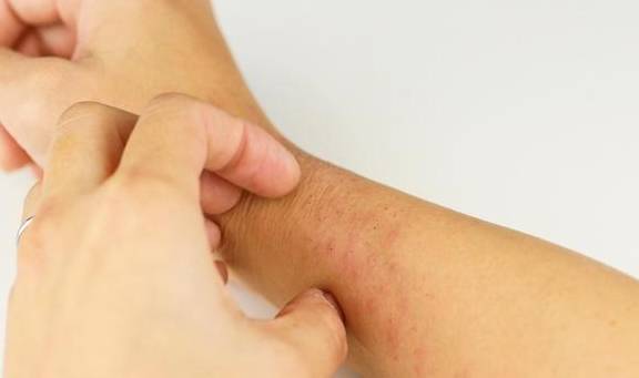 肝内"淤积"毒素,身体会有哪些症状?_肝脏_问题_功能