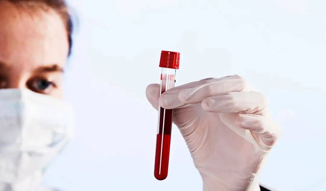 红细胞_抗体_患者