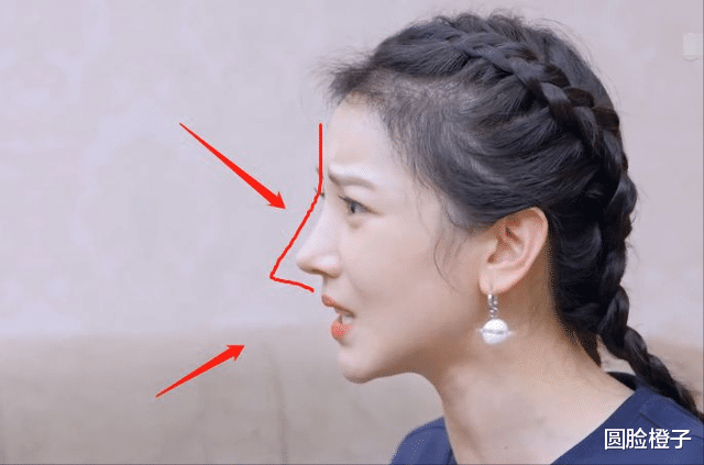 3位"尖鼻孔"女星,隔着屏幕都感觉无法呼吸,为了美也是拼了_鼻子_鼻头
