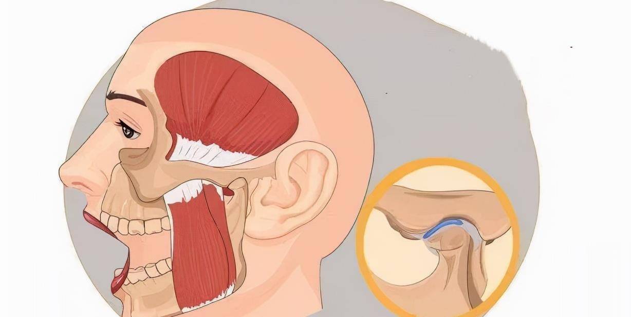 医生直言:这是一种病,5招教你改善_下颌_关节_运动