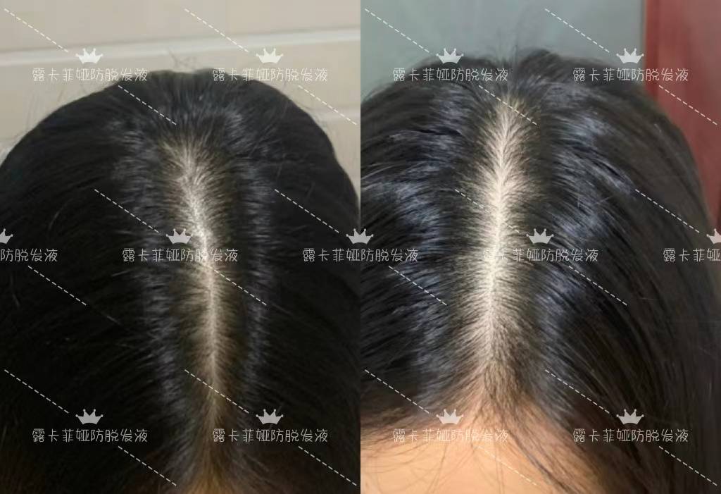 生发养发哪个品牌最好？育发液排名前十名，性价比高（国内知名生发养发品牌）