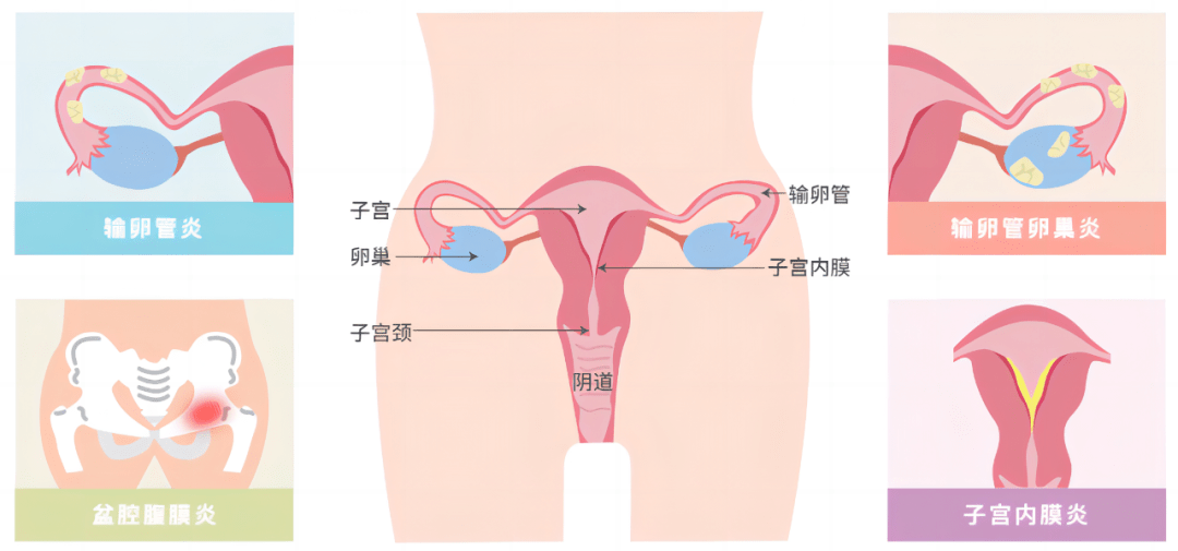 宫颈构造示意图图片