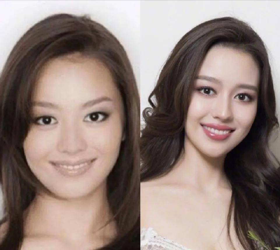 朗朗的妻子吉娜整容前后差距大,朗朗看到后都后悔了_孩子_女生_家庭