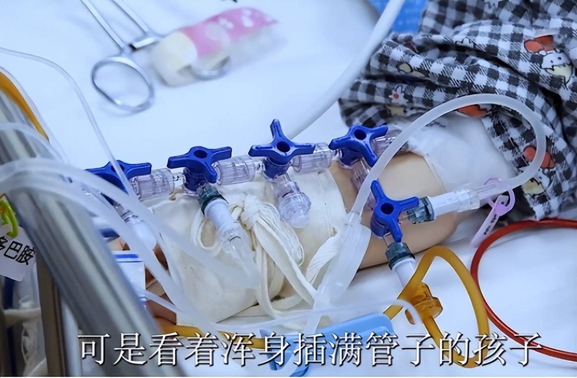 2岁宝宝被妈妈拔掉氧气管,医生却表示支持,背后原因令人心碎_孩子_瑞