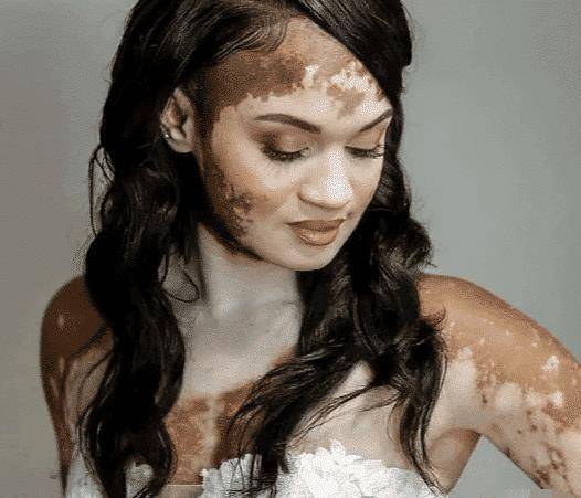 "这是黑人得了白化病,还是白人得了黑化病?"_大哥_新娘_妹子