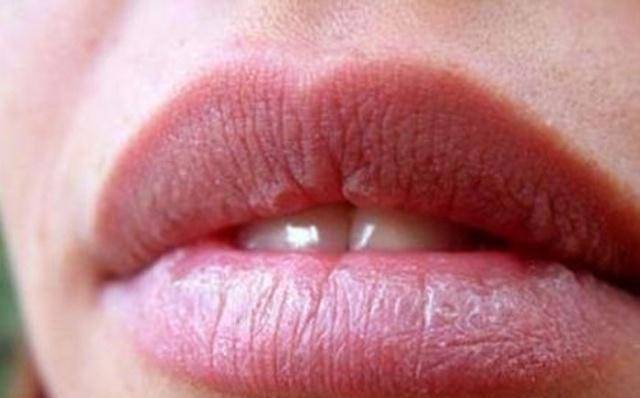 嘴唇这几种颜色,可能是身体疾病信号
