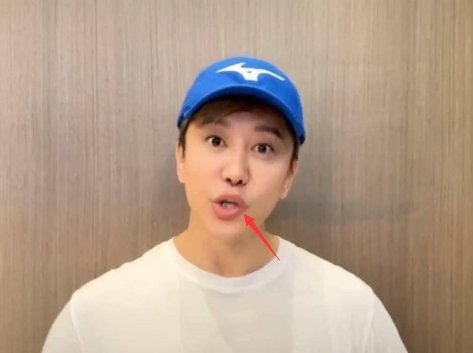 毛宁:为吴绮莉打call,嘴歪模样大变认不出,网友直呼"换头"_嘴巴_视频