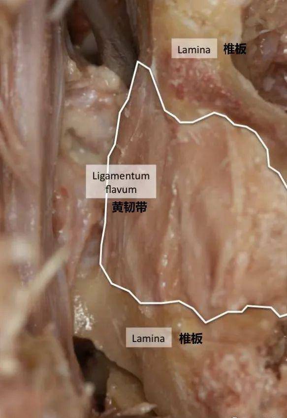 黄韧带 解剖图片