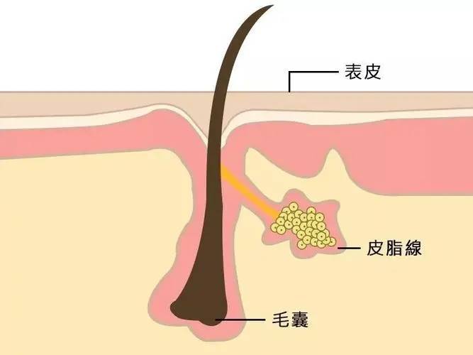 兰肤妍小课堂 皮脂腺影响逻辑与作用机理