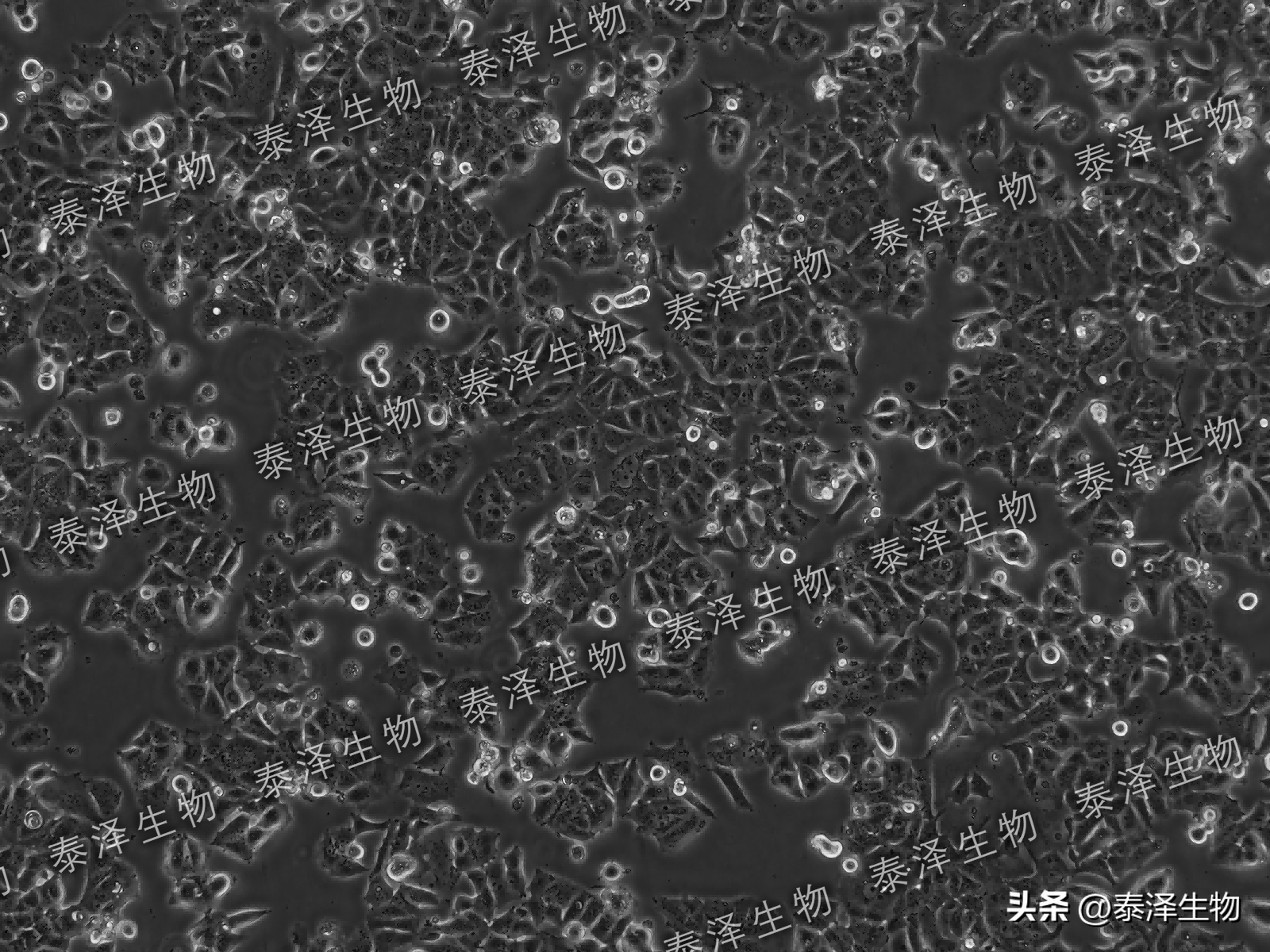 mcf7 人乳腺癌细胞 基础介绍与培养传代_ml_培养基_进行