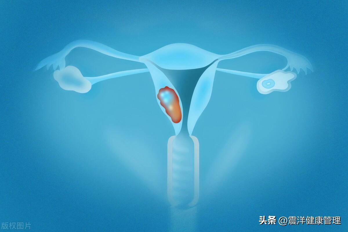 女性下面有味,内裤总是脏脏的,身体到底怎么了?