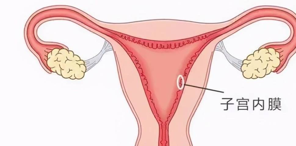 子宫内膜薄是由什么原因引起的(子宫内膜薄怎么调理恢复月经)