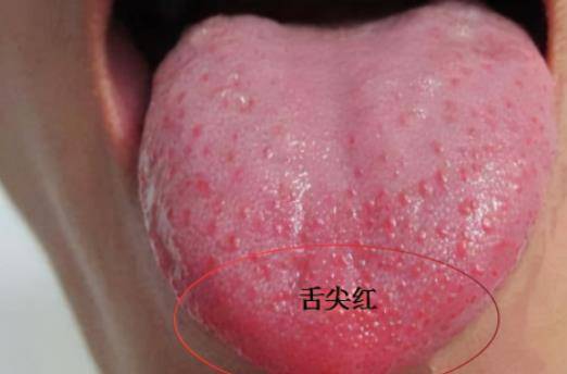 千古化痰第一方,化老痰,顽痰,顽痰一除,三焦畅通,一身轻松_崔医生