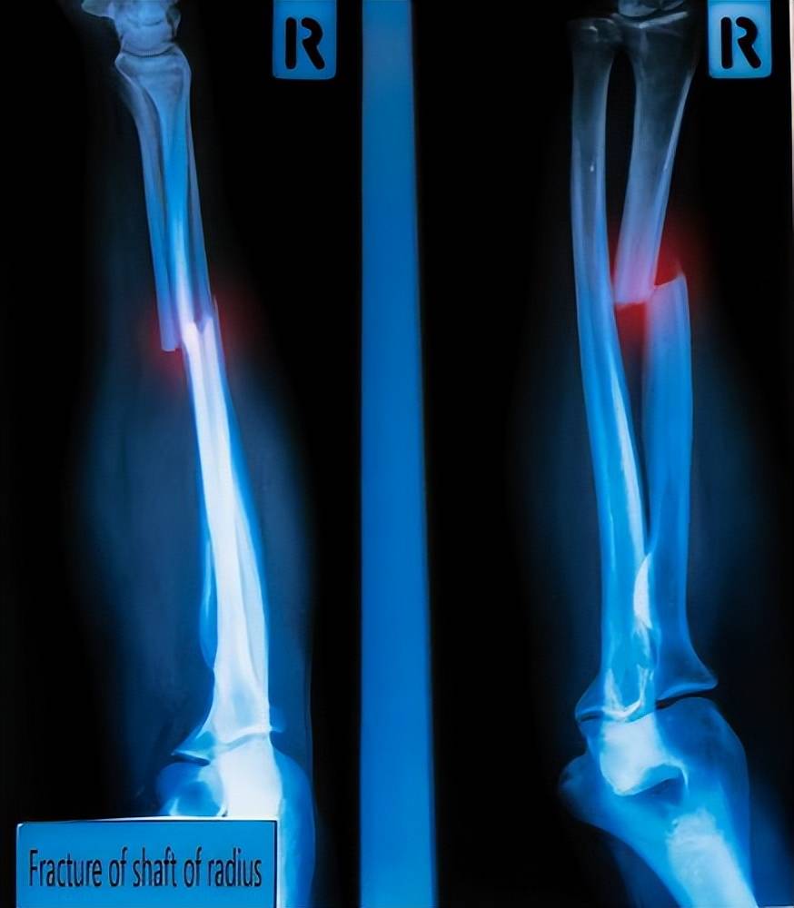 磁共振（MRI）和CT有什么区别(附5大区别)