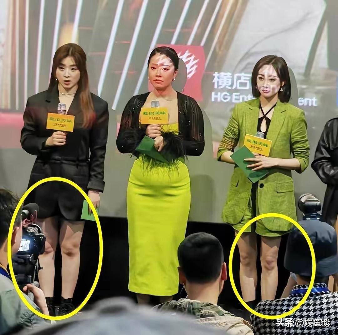 除了王菊被吐槽肚子太明显,甜美少女张含韵也逃不过.