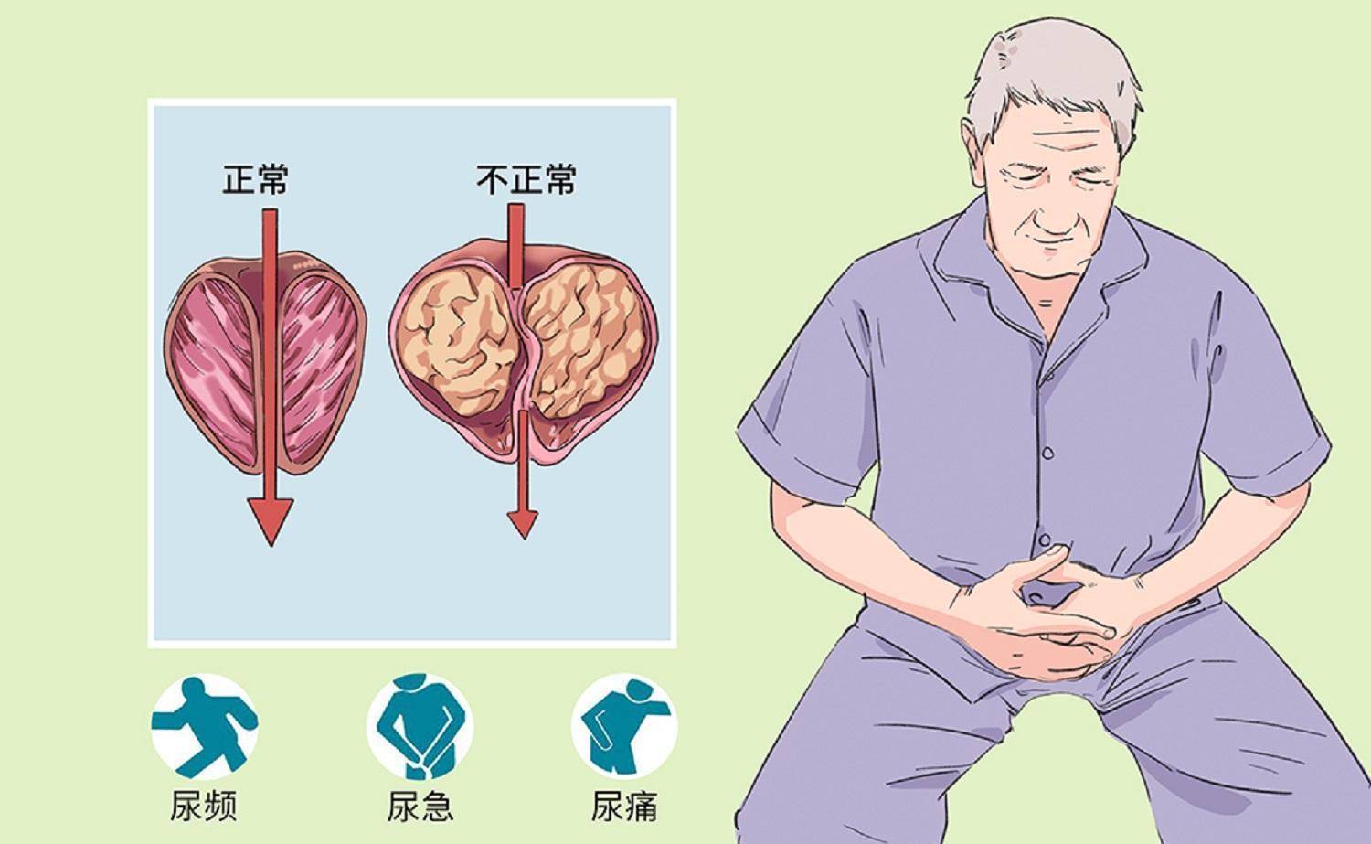 前列腺的主要功能是产生和分泌