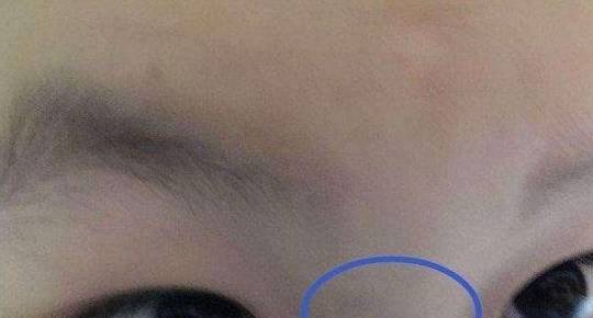 自然科学的角度客观地看,所谓孩子鼻梁上的那根"青筋",就是是宝宝出生