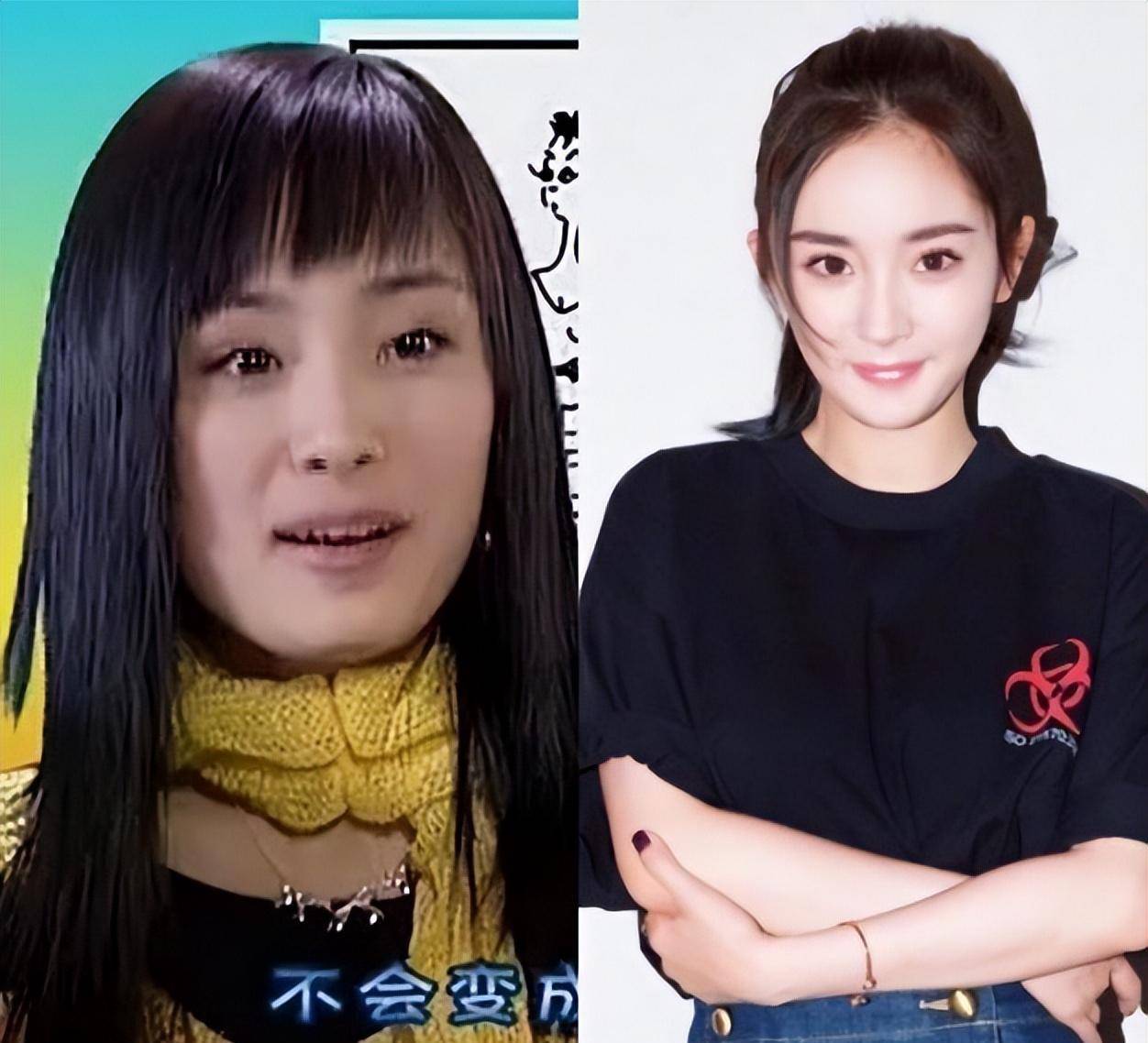 7位整容女星,有人"换头改命"大火,有人适得其反断送前途_张檬_娄艺潇