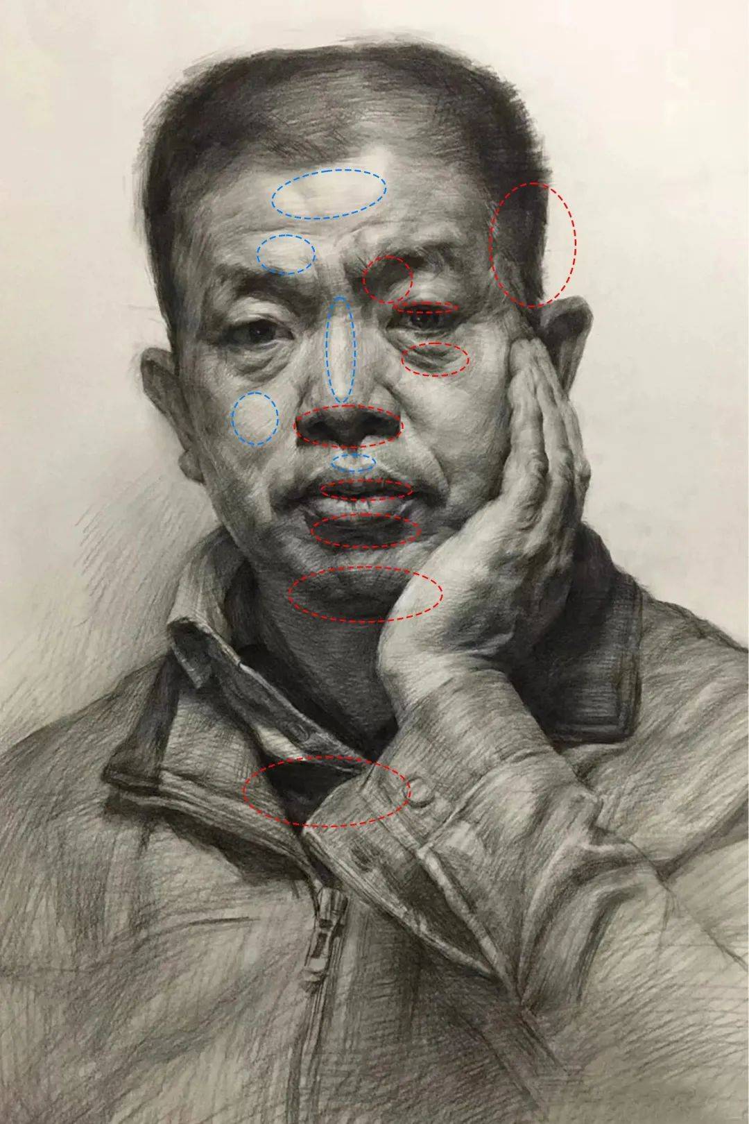 红圈:暗面蓝圈:亮面亮部:两处额结节之间,颧骨,鼻根至鼻球,眼球上方