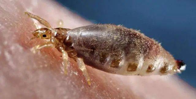 童年的"恐怖"记忆:虱子_头发_篦子_手指